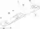 Fig. 01 - Bone resection apparatus