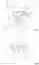 Fig. 06 - Lockable surgical system