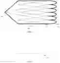 Fig. 07 - Clot retrieval