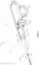 Fig. 05 - Surgical instrument with removable portion to facilitate cleaning