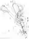 Fig. 16 - Surgical instrument with removable portion to facilitate cleaning