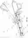 Fig. 17 - Surgical instrument with removable portion to facilitate cleaning