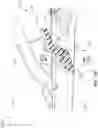 Fig. 20 - Surgical instrument with removable portion to facilitate cleaning