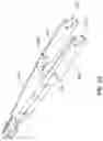 Fig. 33 - Surgical instrument with removable portion to facilitate cleaning