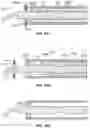 Fig. 37 - Surgical instrument with removable portion to facilitate cleaning