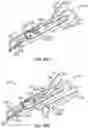 Fig. 47 - Surgical instrument with removable portion to facilitate cleaning