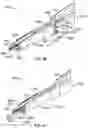 Fig. 51 - Surgical instrument with removable portion to facilitate cleaning