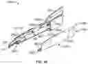 Fig. 52 - Surgical instrument with removable portion to facilitate cleaning