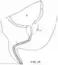 Fig. 03 - Automated image-guided tissue resection and treatment