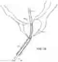 Fig. 04 - Automated image-guided tissue resection and treatment
