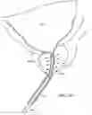 Fig. 05 - Automated image-guided tissue resection and treatment