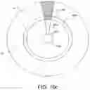 Fig. 14 - Automated image-guided tissue resection and treatment