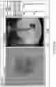 Fig. 40 - Automated image-guided tissue resection and treatment