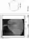 Fig. 45 - Automated image-guided tissue resection and treatment