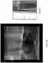 Fig. 64 - Automated image-guided tissue resection and treatment