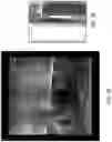 Fig. 65 - Automated image-guided tissue resection and treatment