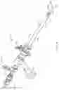 Fig. 07 - Tissue resection system