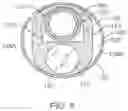 Fig. 08 - Tissue resection system