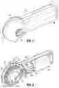 Fig. 03 - Wireless tissue dissector