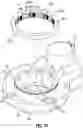 Fig. 11 - Wireless tissue dissector