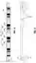 Fig. 13 - Wireless tissue dissector