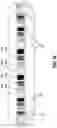 Fig. 14 - Wireless tissue dissector