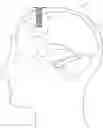 Fig. 01 - Expandable and collapsible brain cannula