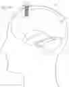 Fig. 10 - Expandable and collapsible brain cannula