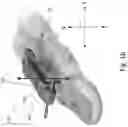 Fig. 03 - DYNAMIC EXTERNAL FIXATOR SYSTEM FOR SMALL JOINTS