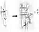 Fig. 19 - DYNAMIC EXTERNAL FIXATOR SYSTEM FOR SMALL JOINTS