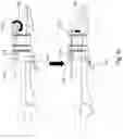 Fig. 29 - DYNAMIC EXTERNAL FIXATOR SYSTEM FOR SMALL JOINTS