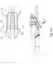 Fig. 33 - DYNAMIC EXTERNAL FIXATOR SYSTEM FOR SMALL JOINTS