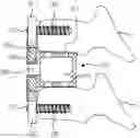 Fig. 01 - Spinal fixation device