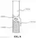 Fig. 10 - Spinal fixation device
