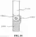 Fig. 12 - Spinal fixation device