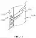 Fig. 13 - Spinal fixation device