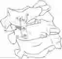 Fig. 01 - Lateral mass fixation implant