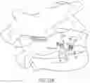 Fig. 14 - Lateral mass fixation implant