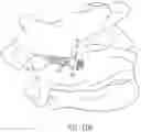 Fig. 15 - Lateral mass fixation implant