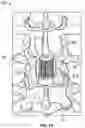 Fig. 02 - SYSTEMS AND METHODS FOR A SPINAL IMPLANT