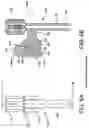 Fig. 08 - ORTHOPEDIC COMPRESSION/DISTRACTION DEVICE