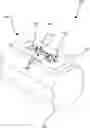 Fig. 01 - Staple and plate hard tissue fixation