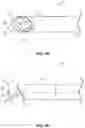 Fig. 11 - ALL-IN-ONE ODONTOID FIXATION GUIDE APPARATUS, SYSTEMS, AND METHODS