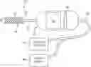 Fig. 01 - Methods and devices to treat nasal airways