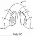 Fig. 04 - Methods and devices to treat nasal airways