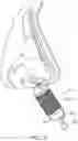 Fig. 08 - Methods and devices to treat nasal airways
