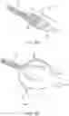 Fig. 10 - Methods and devices to treat nasal airways