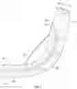 Fig. 06 - Sphincterotome device and methods and uses thereof