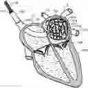 Fig. 01 - Medical device for use in bodily lumens, for example an atrium