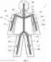 Fig. 04 - Patient positioning using a skeleton model